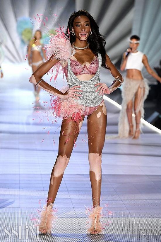 Winnie Harlow ͼƬԴGetty Images